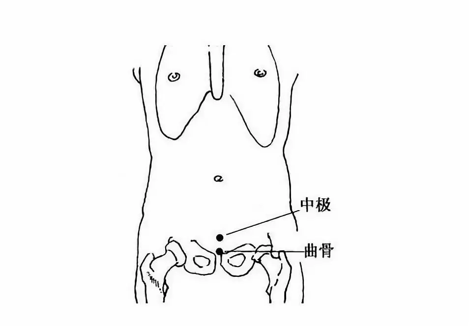 取法:仰卧,于腹部中线,耻骨联合上缘凹陷处取穴.