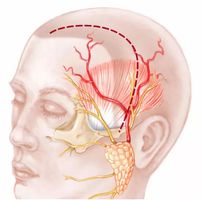 眶上神经通过眶上神经孔或眶上神经切迹出眼眶 在前额部分成内外两支