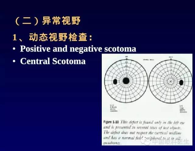 高手支招视野计及其检查判读方法