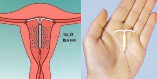 耳道冲洗后头晕恶心的原理是什么_头晕恶心吃什么药图片