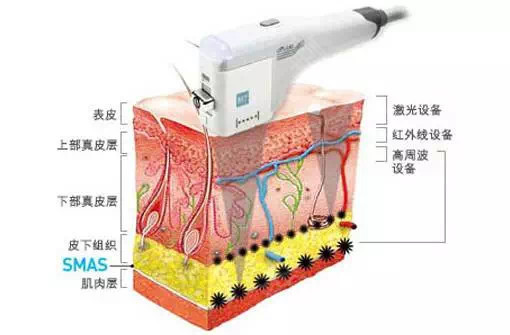 点阵射频的原理是什么_点阵式布局是什么意思