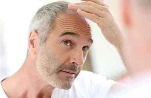 白头发多的人是染发好还是不染好?适合做什么发型?