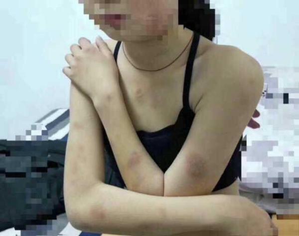 清河通报校园欺凌 事件被曝光女生现状惨不忍睹