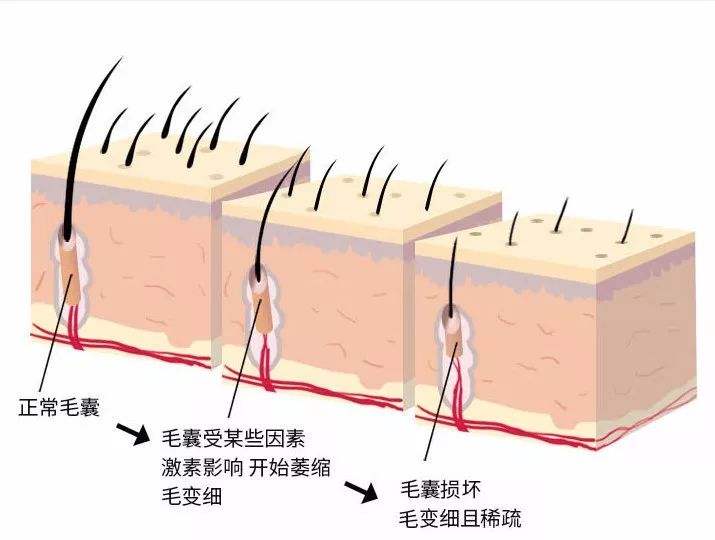 让涂抹后壳释放保湿因子,有效滋养干枯毛囊,而生物素则可增加了胡子的