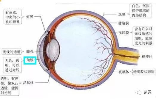 全飞秒近视手术的原理_全飞秒(3)