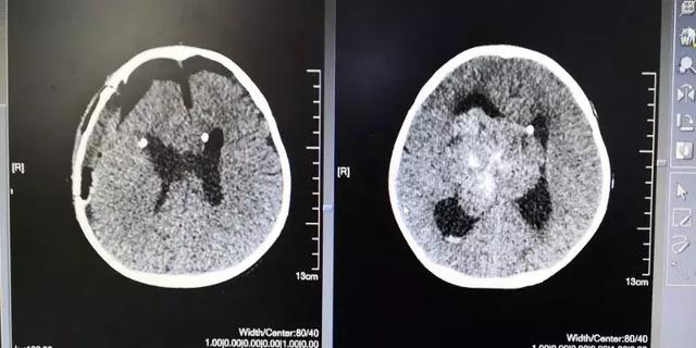 4岁宝宝一直吐怎么办