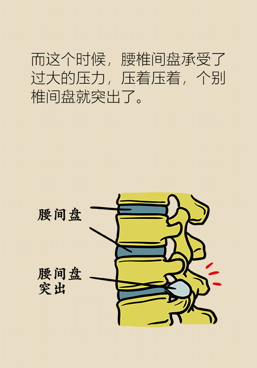 才30多歲就腰椎間盤突出了，原來都是這些動作害的！ 健康 第8張