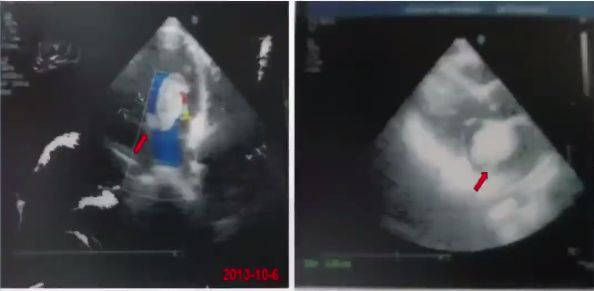 病人口里有白色粘液_鸽子嘴有白色粘液图片(2)