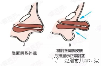 鸡吧太小怎么办