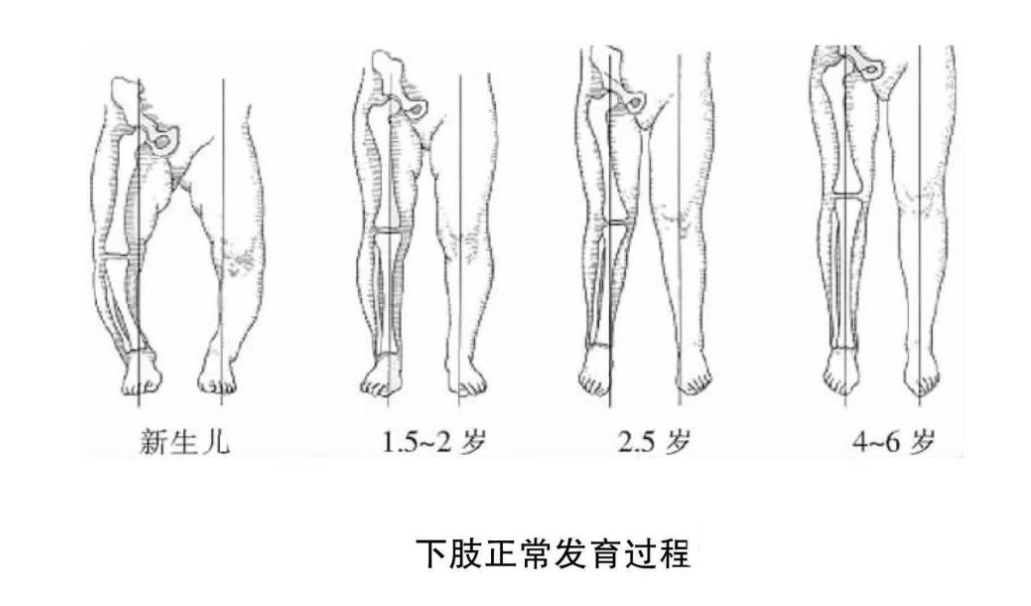 一个鬼被红绳绑着双腿猜成语_看图猜成语(2)