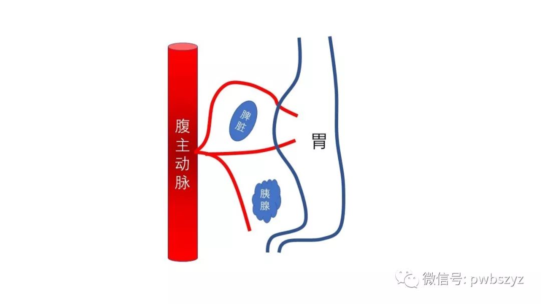 大话胃癌第三季第十五集腹腔镜下脾门淋巴结清扫上