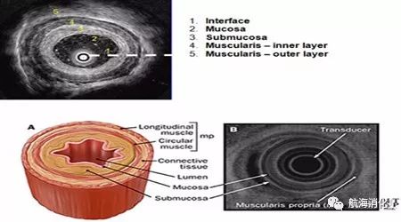(3)超声内镜与体外b超不同之处:由于超声探头更靠近病变,减少了体外
