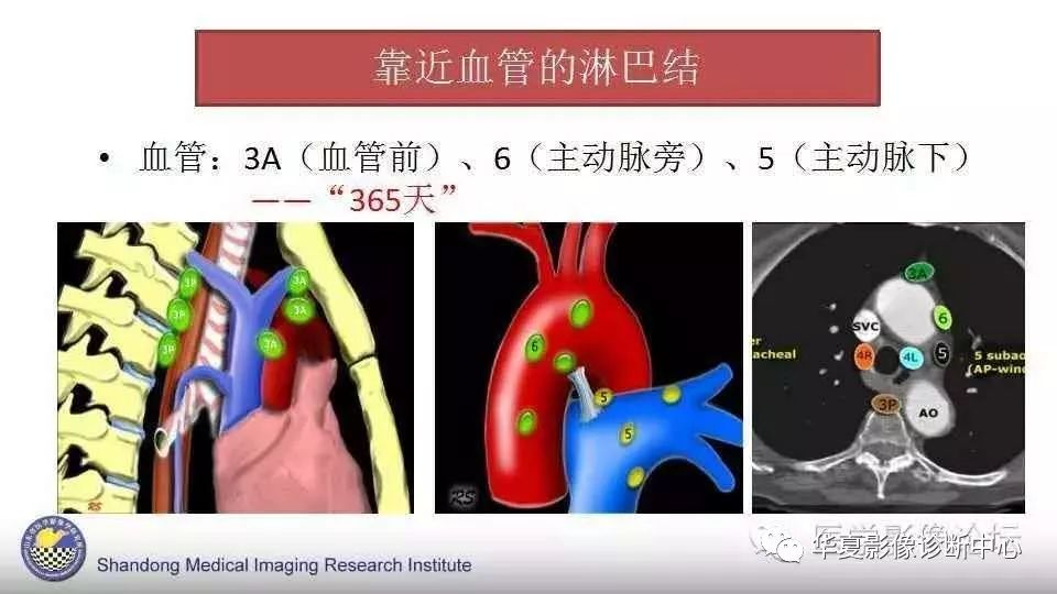 史上最全胸内淋巴结分区图解