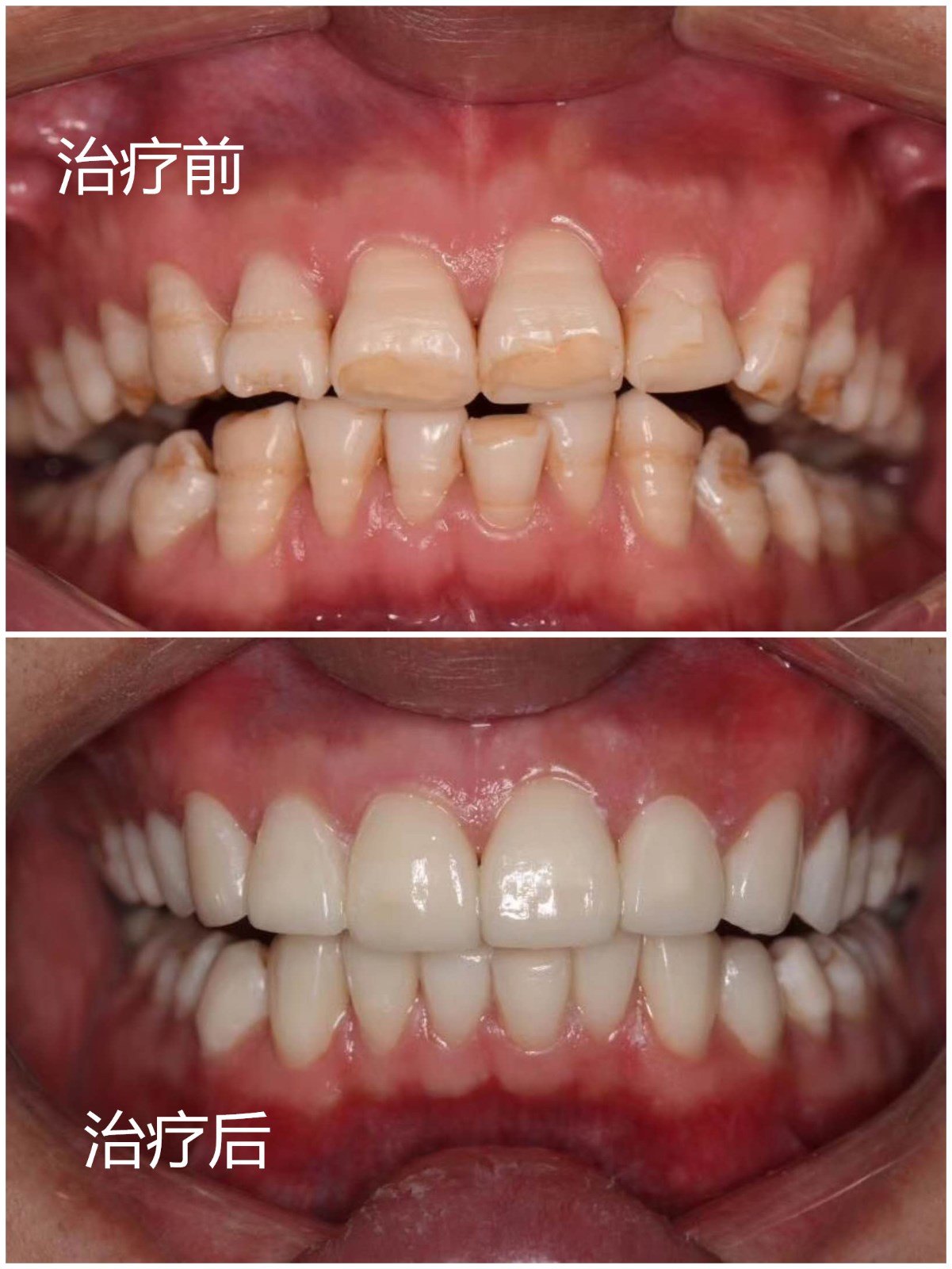 病人口误医生可以修改病例吗_病例单图片