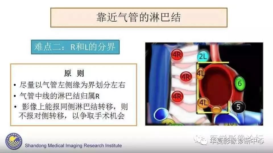 史上最全胸内淋巴结分区图解