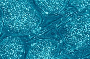 幹細胞移植治療癌症的效果如何？幹細胞真的能治癌症？ 科技 第3張