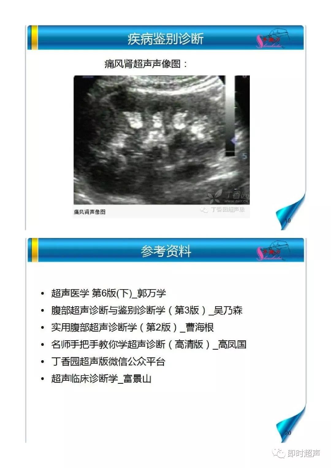 海绵肾超声诊断要点及鉴别诊断