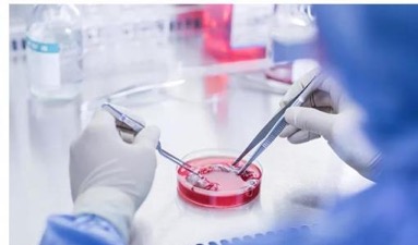 幹細胞移植治療癌症的效果如何？幹細胞真的能治癌症？ 科技 第2張