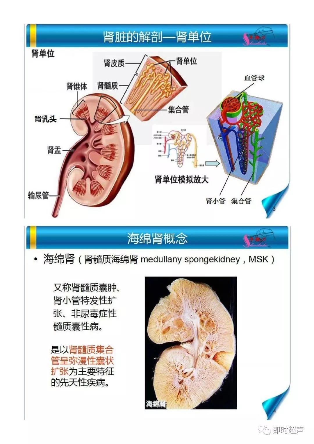 海绵肾超声诊断要点及鉴别诊断