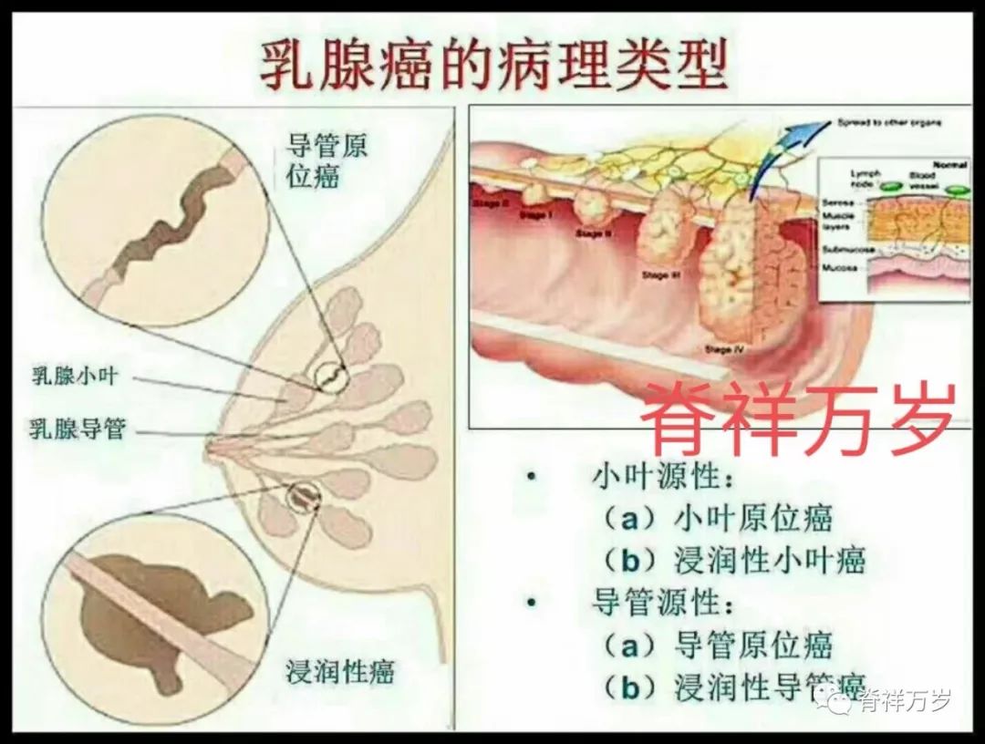 哺乳期小肠火怎么办