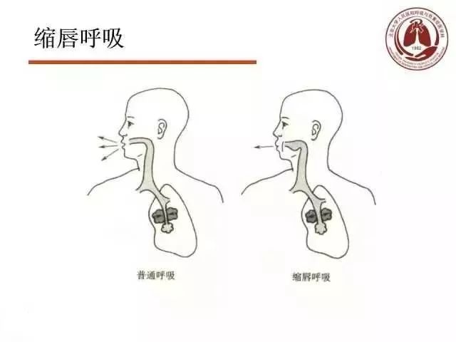 留言解读——【肺康复】