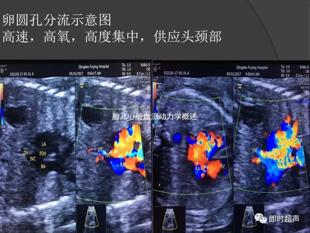胎儿心脏标准切面及扫查示例