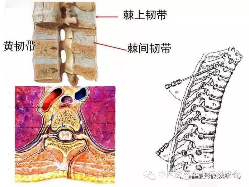 详细人体解剖之脊柱医学课件大家都收藏了