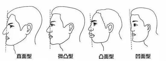 为什么有人垫的鼻子又土又假 看起来一点都不高级 热备资讯