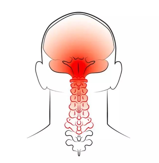 偏头痛的原理_神经末梢炎