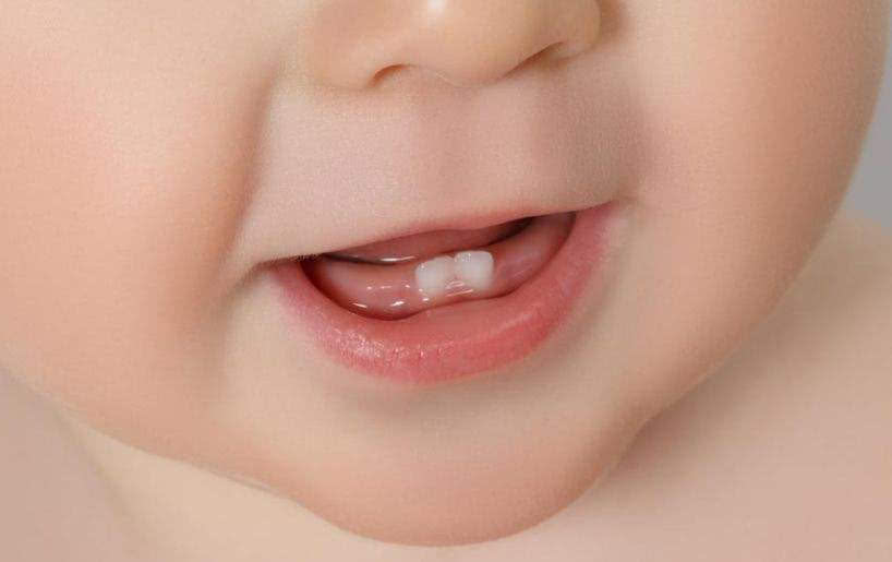 在保护宝宝牙齿方面你怎样才能算一个精致的父母呢