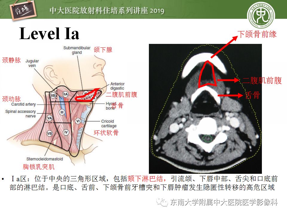 【2018住培系列讲座 第45期】颈部淋巴结的影像解剖及