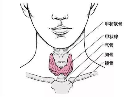 甲状腺结节是什么?有哪些症状?