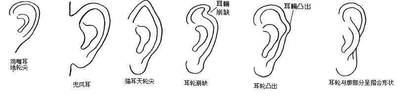 7.2《麻衣相法》说"轮廓分明有堕珠,一生仁义最相宜.