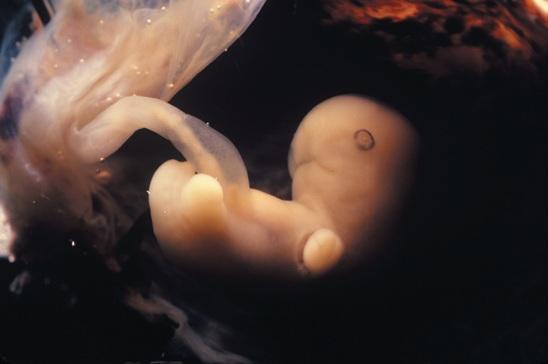 第6周的胎儿在妊娠(怀孕)第1个月即将结束的时候,胎儿已经长出了略圆