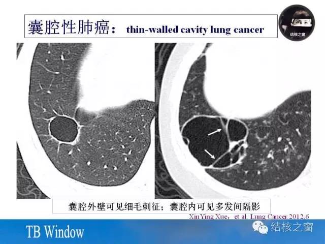 z型腔怎么搭_囗腔溃疡怎么治疗(2)