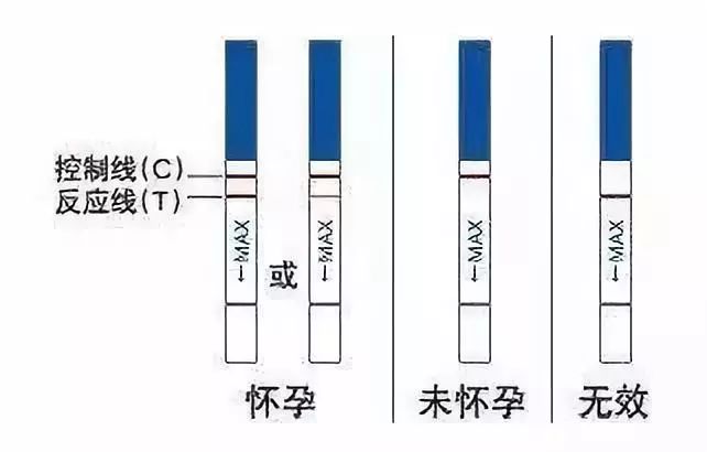 膝胸卧位原理是什么意思_膝卧位是什么姿势图片(3)