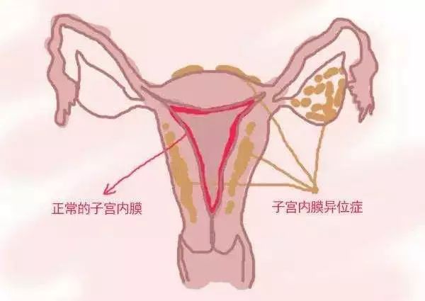 带节育环不怀孕是什么原理_节育环带在什么位置(3)