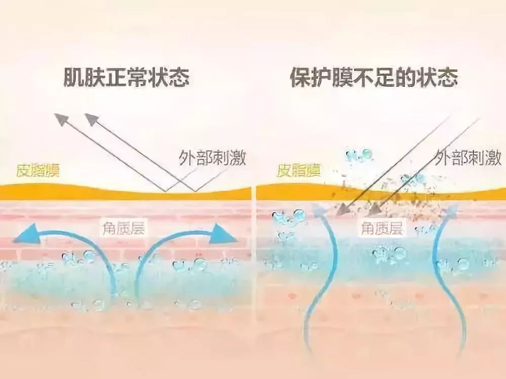 记住这句话:水油平衡是一切好皮肤的"肌"础,保湿,保湿,请一定要做好