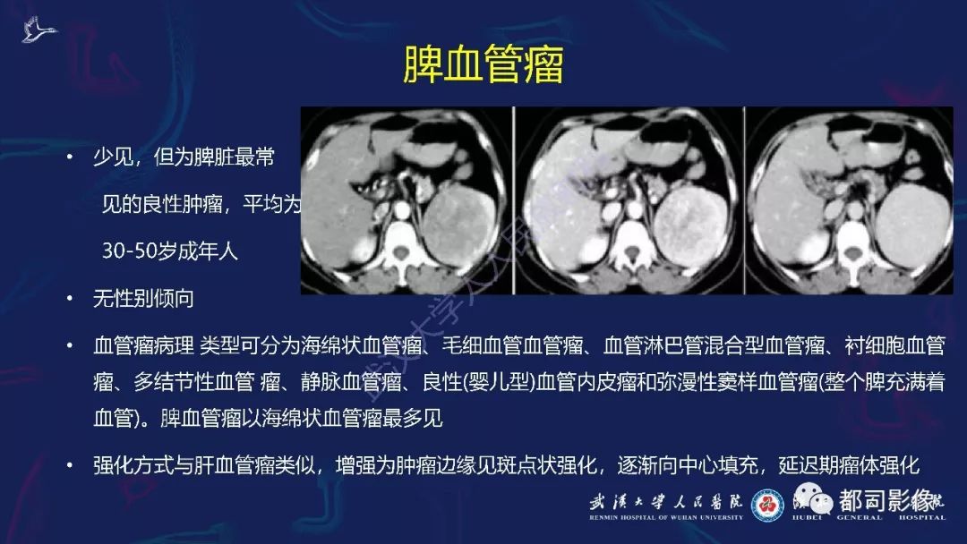 脾脏窦岸细胞血管瘤影像诊断