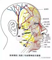 针刀治疗面肌痉挛症