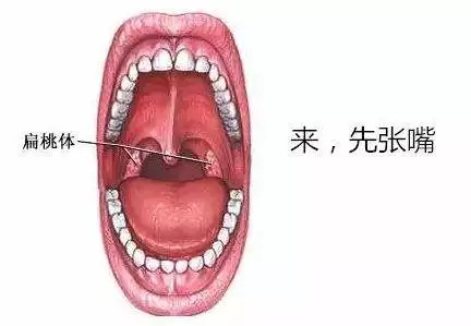 扁桃体是我们身体的免疫系统,免疫系统对我们人体是非常重要的