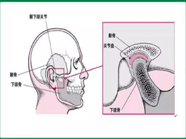 手法复位治疗颞颌关节脱位