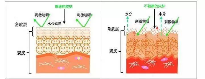 皮肤水合过度怎么办