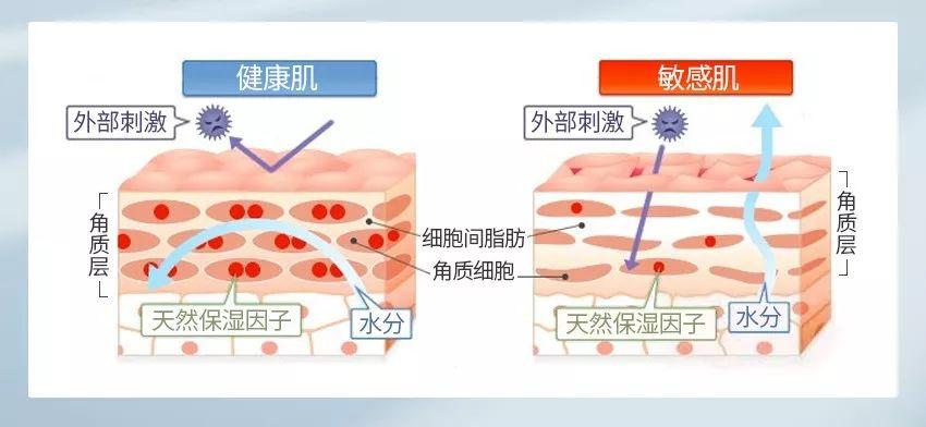 容美泉 | "敏感肌"小测试!符合两项及以上就中招啦