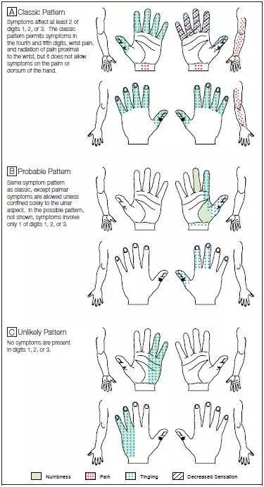 一文掌握「腕管综合征」的诊治_诊断