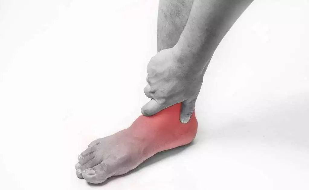 踝关节扭伤后,近20%的人还会频繁扭伤!上海专家告诉你
