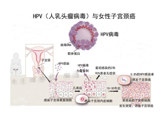 hpv阳性值很高怎么办