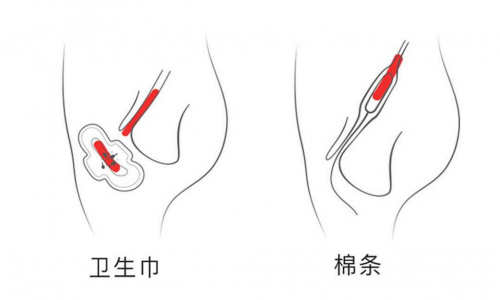 来月经泡了温泉怎么办