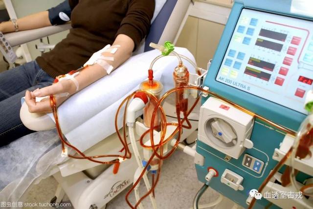 What Does A Dialysis Machine Look Like