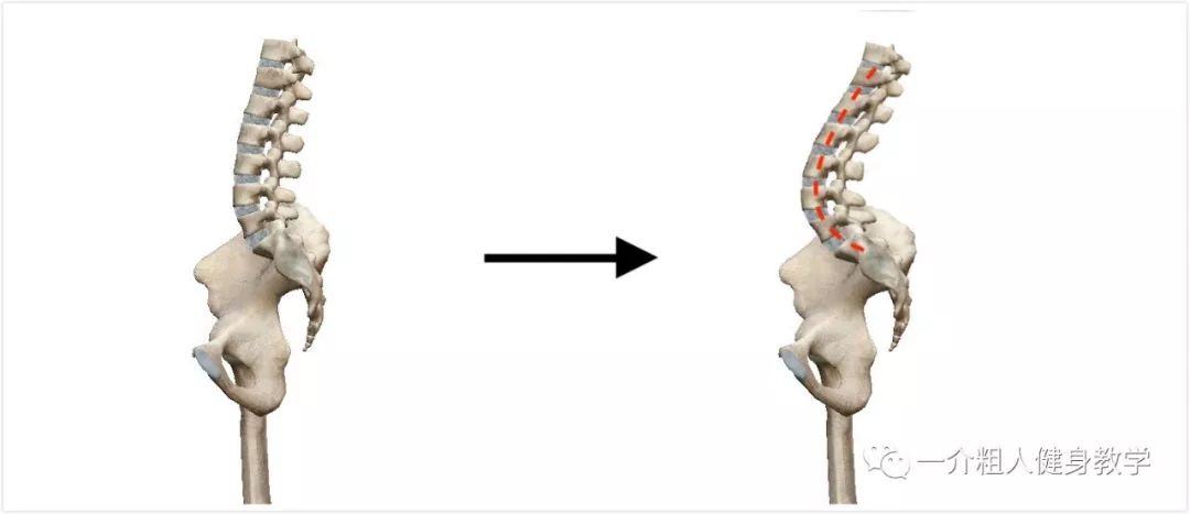 训练时为什么会腰椎过度反弓(附解决思路)?